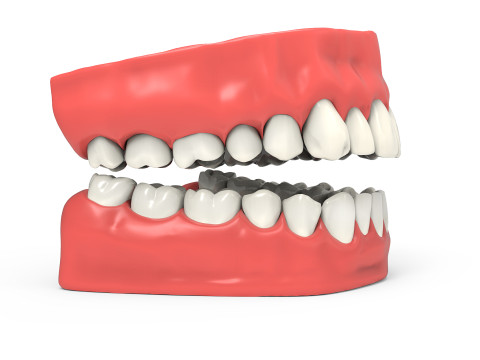 Teeth 3D Model