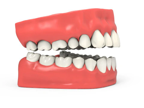 Teeth 3D Model