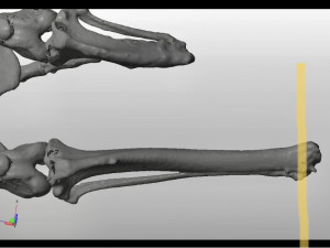 itap implant osteointegration operation Modelo 3D