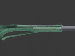 itap implant osteointegration operation 3D Model