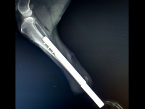 itap implant osteointegration operation Modelo 3D