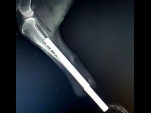 itap implant osteointegration operation 3D Model