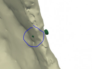 the plate for cranioplasty real example 3D 모델