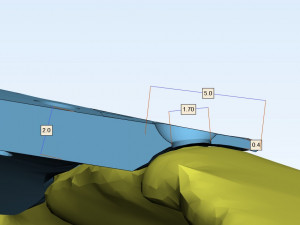 the plate for cranioplasty real example 3D 모델