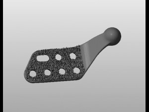 individual tmj prosthesis real operation Model 3D