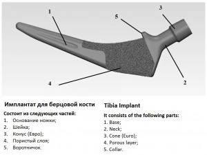 tibia implant real model for training 3D Model