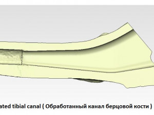 tibia implant real model for training 3D मॉडल