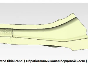 tibia implant real model for training 3D Model