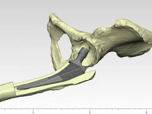 tibia implant real model for training 3D Model