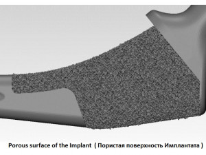 tibia implant real model for training 3D मॉडल