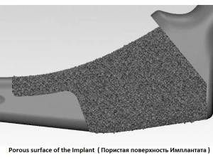 tibia implant real model for training 3D Model