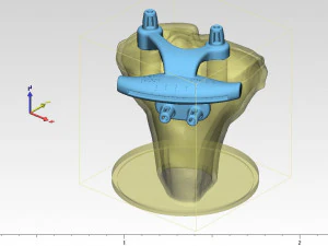 knee joint prosthesis with guides sample of individual prosthetics 3D Model