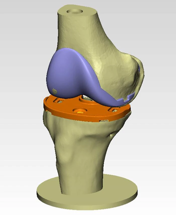 knee joint prosthesis with guides sample of individual prosthetics 3D Model .c4d .max .obj .3ds .fbx .stl .blend