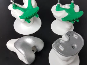 knee joint prosthesis with guides sample of individual prosthetics 3D Model