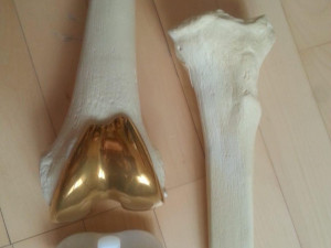 knee joint prosthesis with guides sample of individual prosthetics Modelo 3D