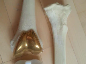 knee joint prosthesis with guides sample of individual prosthetics 3D Model