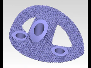 individual acetabulum augment 3D Print Model