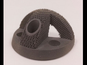 individual acetabulum augment Modèles 3D en vedette