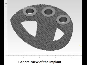 individual acetabulum augment 3D Print Model