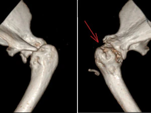prosthetics of the cats shoulder an example of a real operation 3D Print Model