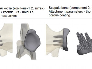 prosthetics of the cats shoulder an example of a real operation 3D Print Model