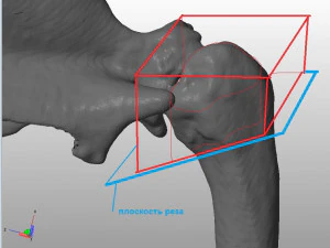 prosthetics of the cats shoulder an example of a real operation 3D Print Model