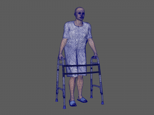 Patient with Walker 3D Model