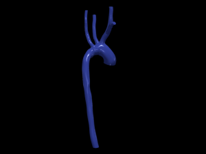 Aorta 3D Model