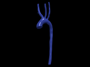 Aorta 3D 모델