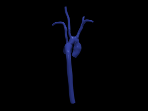 Aorta 3D Model
