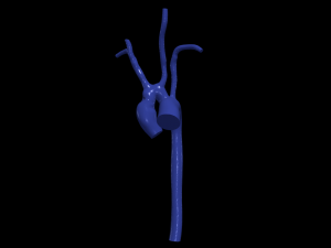 Aorta 3D 모델
