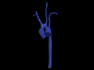 대동맥 3D 모델