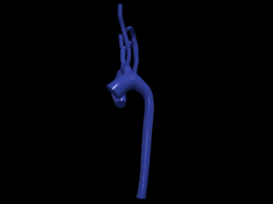 Aorta 3D 모델