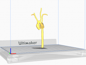 Aorta 3D 모델