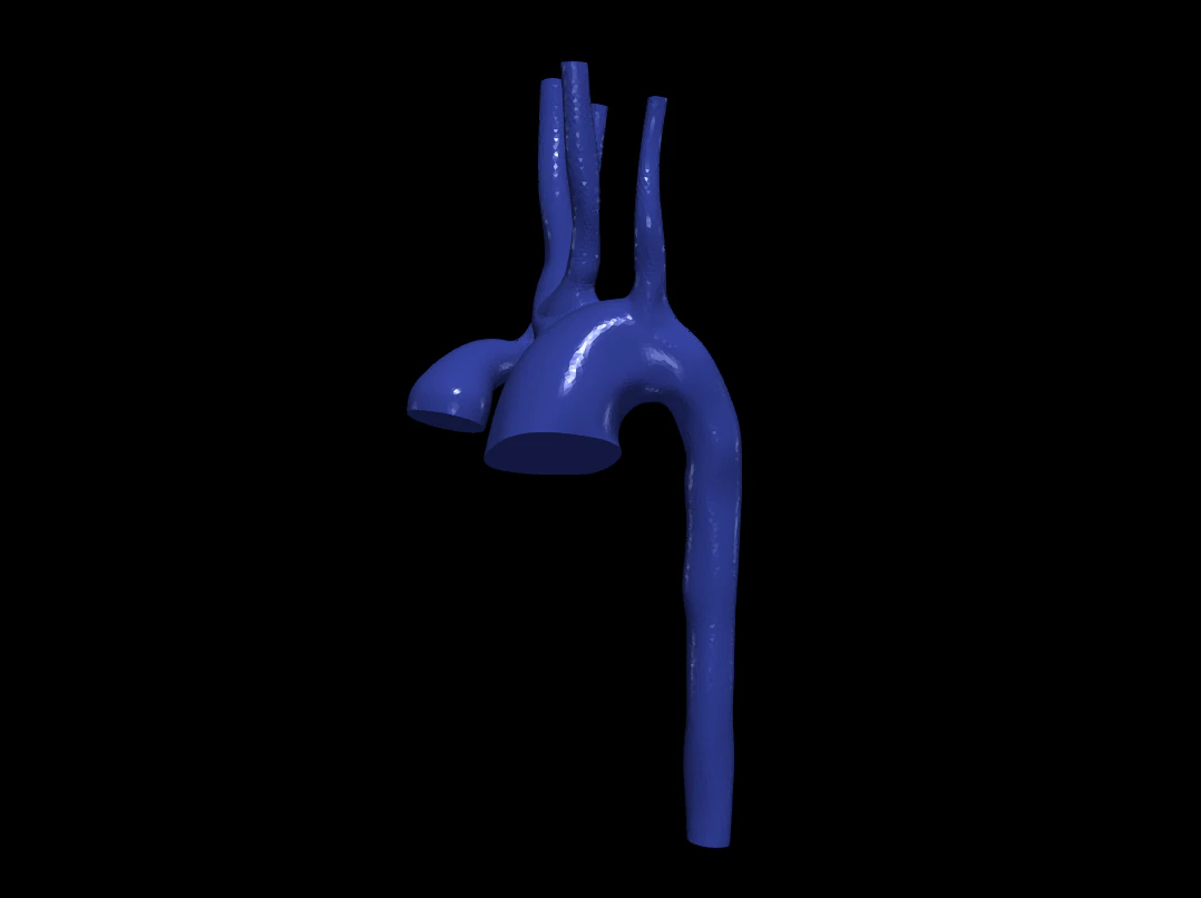 Aorta 3D Model .c4d .max .obj .3ds .fbx .stl .blend 