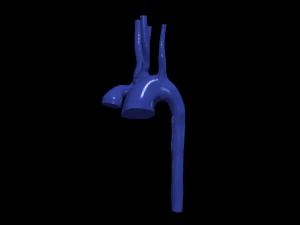 Aorta 3D Modell