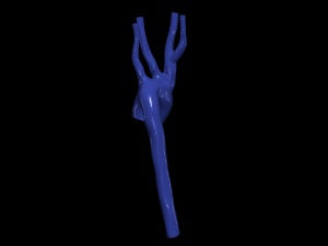 Aorta 3D 모델