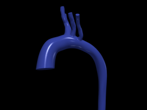 Aorta 3D Model