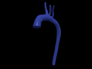 Aorta 3D 모델