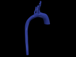 Aorta 3D 모델