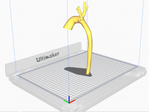 Aorta 3D 모델
