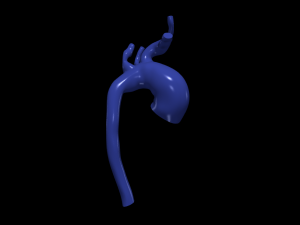 Aorta 3D Model