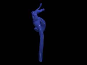 Aorta 3D Model