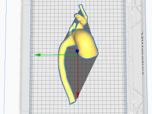 Aorta 3D Model