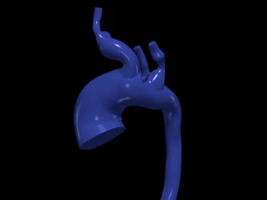 대동맥 3D 모델