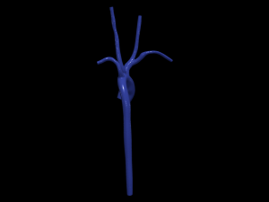 Aorta 3D 모델