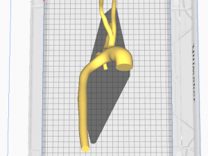 Aorta 3D 모델