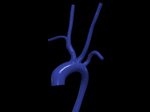 Aorta Modelo 3D