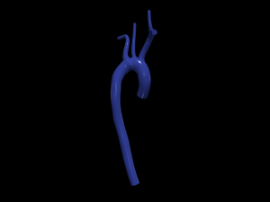 Aorta 3D 모델