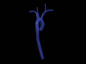 Aorta 3D 모델